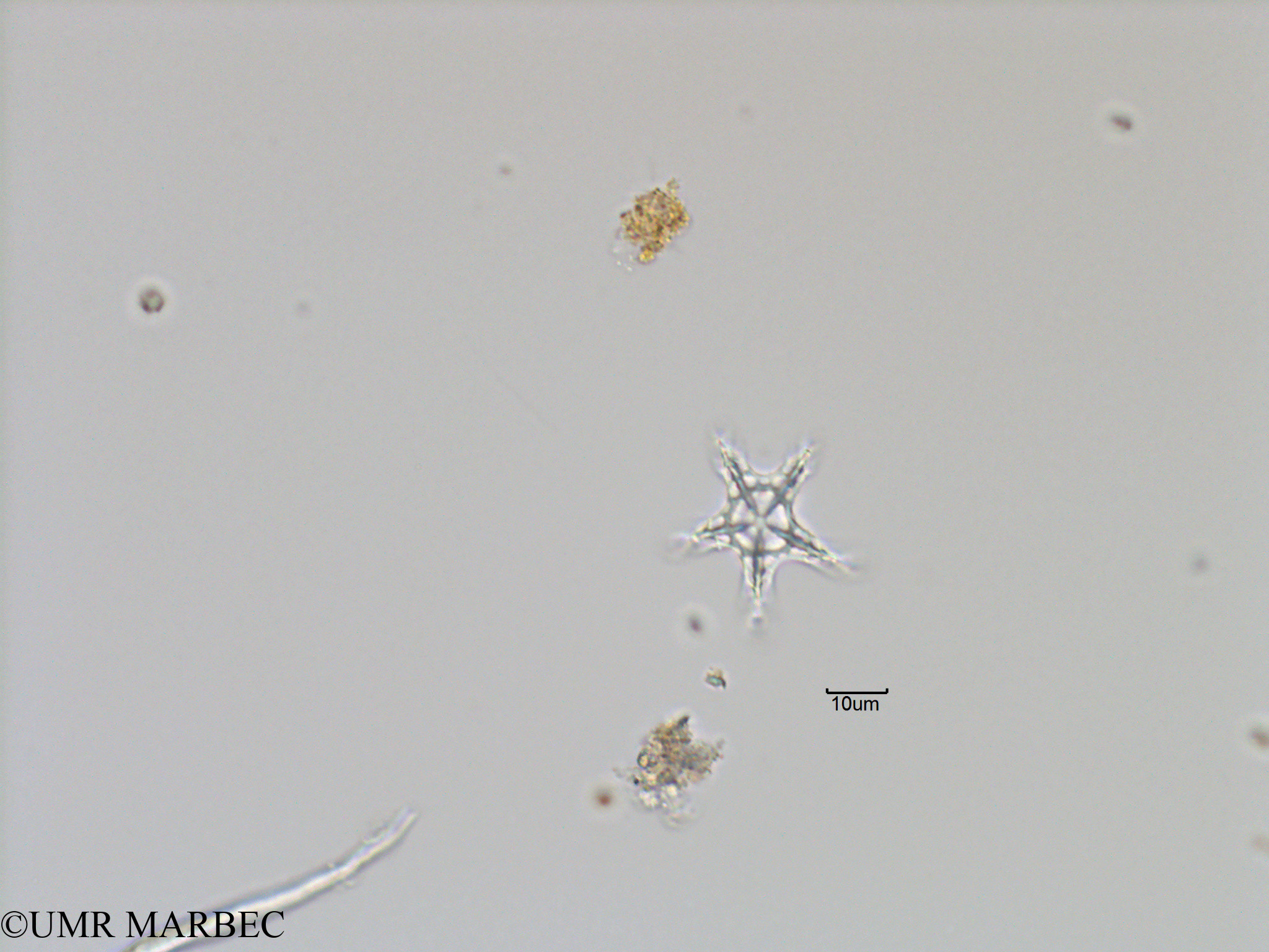 phyto/Bizerte/bizerte_bay/RISCO November 2015/Actiniscus pentasterias (Baie_T5-C1-Etoile-3).tif(copy).jpg